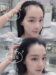 -OnFaer.纹眉半永久无创洗眉