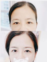 -MIVI半永久纹眉绣眉