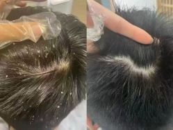 -诗碧曼养发