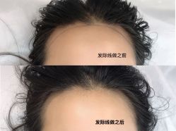 -久匠·野生眉半永久纹绣
