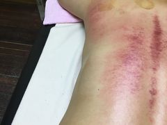 -沈师傅盲人按摩工作室(密三小区店)