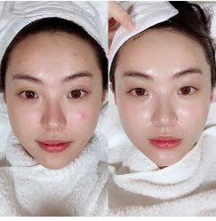 -素妍印象Ekrin Medi Clinic