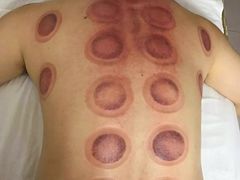 -安琪盲人按摩调理草本熏蒸馆(风和日丽店)