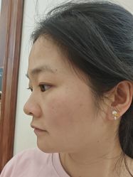 -长沙雅美医疗美容医院