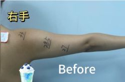 体验前-南京康美美容医院·旗舰店