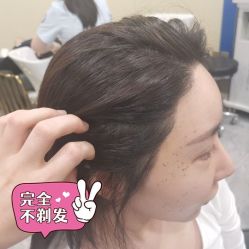 -碧莲盛不剃发植发