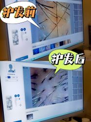 -史云逊养发护发