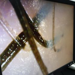 -章光101防脱养发荟