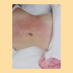 -Lily纤美·科技减脂中心