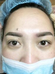 -郡艺医疗美容·微整·眼鼻吸脂