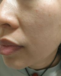 -北京美痣堂古方祛痣斑疣瘊