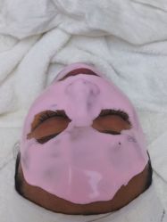 体验后-痘院长·祛痘·科技美肤