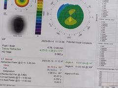 -上海大学附属上海和平眼科医院