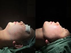 -郡艺医疗美容·微整·眼鼻吸脂