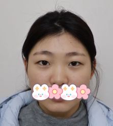 -天津健丽·去眼袋医疗美容机构