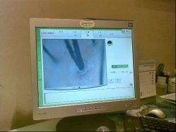 22-史云逊养发中心