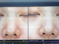 -苑苑vbeauty科技美容SPA