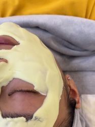 体验后-清颜堂丨分子祛痘·功效美肤