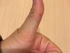 -裕和堂中医推拿艾灸(太古汇臻品店)