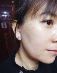 -赢韵美甲美睫瑞士净斑中心