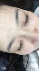 点击看大图 -郡艺医疗美容·微整·眼鼻吸脂
