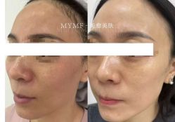 -美愈美肤MEIYU SKIN