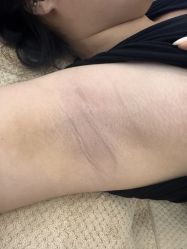 -薇兰专业脱毛连锁机构