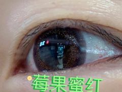 -宝岛眼镜(北京亚运村旗舰店)