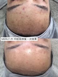 -MLP美丽派·问题肌疗愈中心