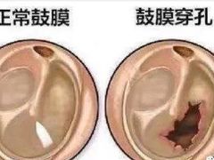 -惠耳听力助听器(霍邱新蓼大道店)