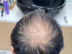 -陕西广播电视塔