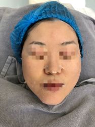 -纯粹医美
