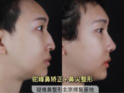 -北京米扬丽格医疗美容·联合丽格鼻整形中心