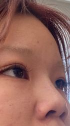 体验后-上海玫瑰医疗美容医院