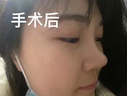 体验后-北京炫美医疗美容