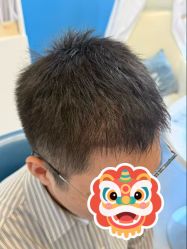 点击看大图 -大麦微针植发全国连锁