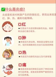 -克丽缇娜