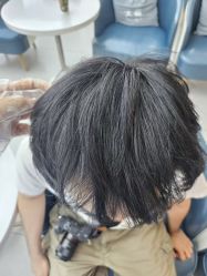 -大麦微针植发全国连锁