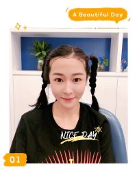 点击看大图 体验后-大麦微针植发全国连锁