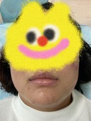-宜肤清颜专业祛痘问题肌修护