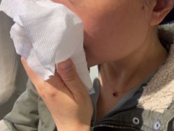 -四川米兰柏羽医学美容医院