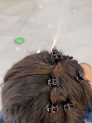 -碧莲盛不剃发植发
