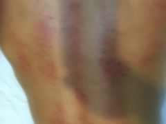 -益友堂盲人推拿正骨穴位按摩工作室