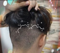 -大麦微针植发全国连锁