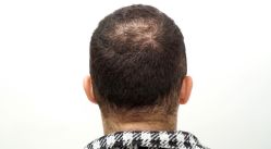 -发饰美男士增发补发假发定制店