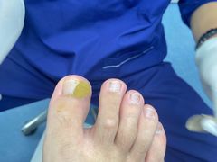 -Andrew指甲专科灰指甲·甲沟炎矫正·3D步态矫形鞋垫定制(上海法华镇路旗舰店)
