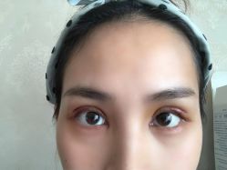 -素美医疗美容·西南眼鼻整形·修复基地