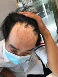 -发饰美男士增发补发假发定制店