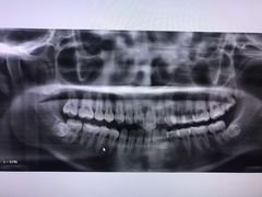 -土豆口腔(凤凰北总店)