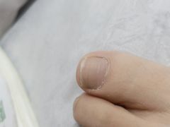 -新甲连锁灰指甲·甲沟炎·鸡眼(黑龙江路店)